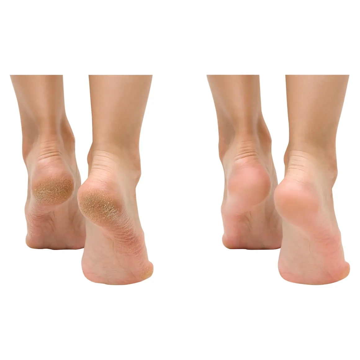 Anti-Fuss- und Nagelpilzspray, 100 ml