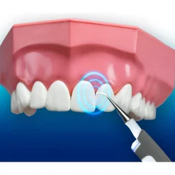 DentaPic Sonic Schall-Zahnreiniger