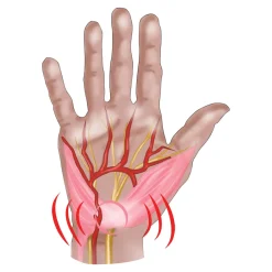 Handgelenkbandage rechts