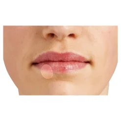 Herpes-Patch, 6 Stück