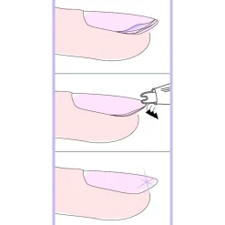 Nagelversieglungsgerät + Gratis Nagelhärter, 12 ml