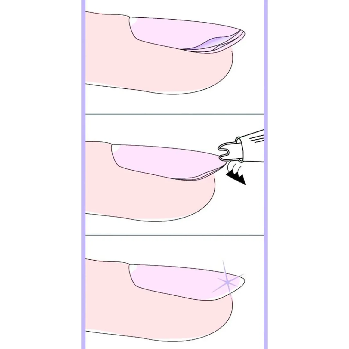 Nagelversieglungsgerät + Gratis Nagelhärter, 12 ml