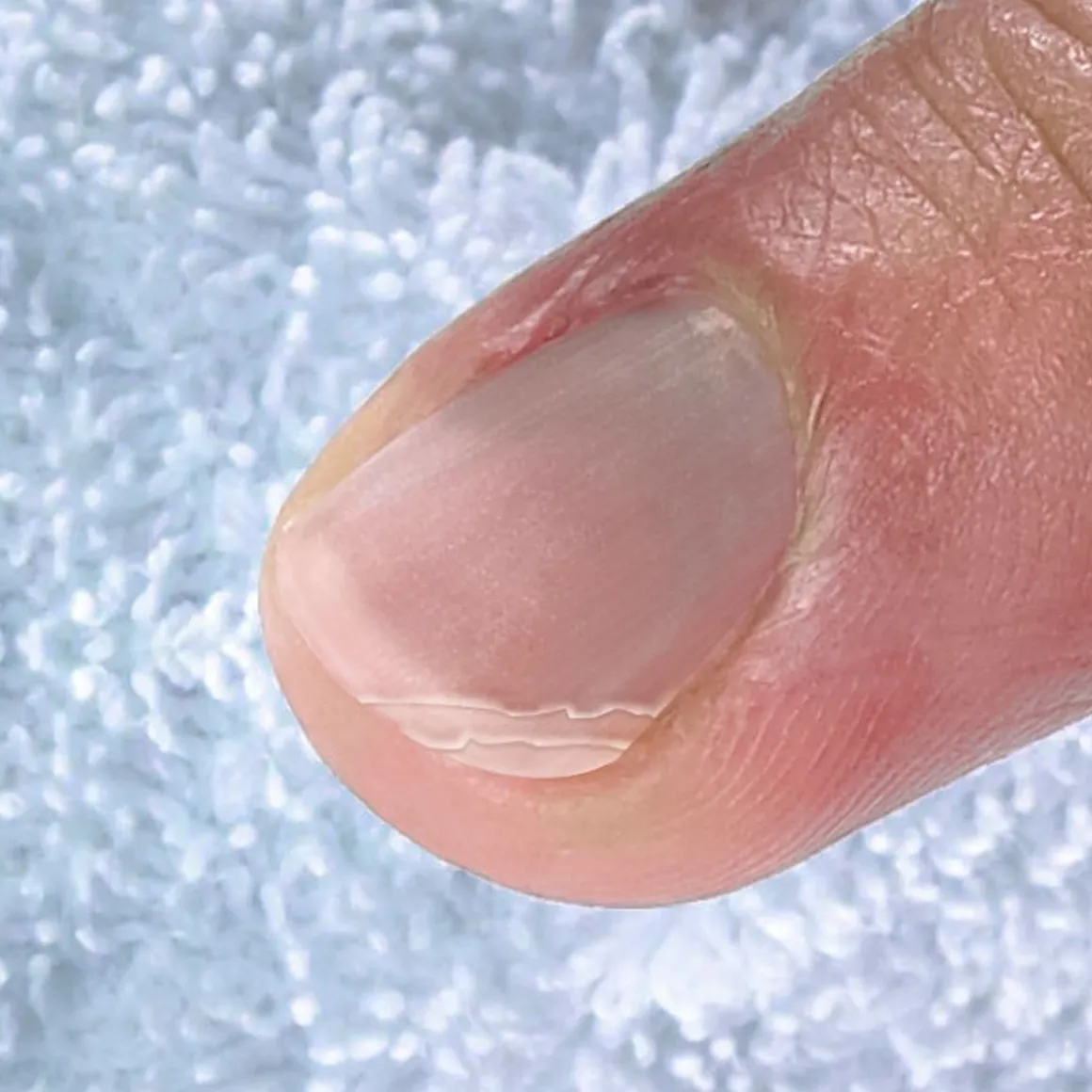 Nagelversieglungsgerät + Gratis Nagelhärter, 12 ml