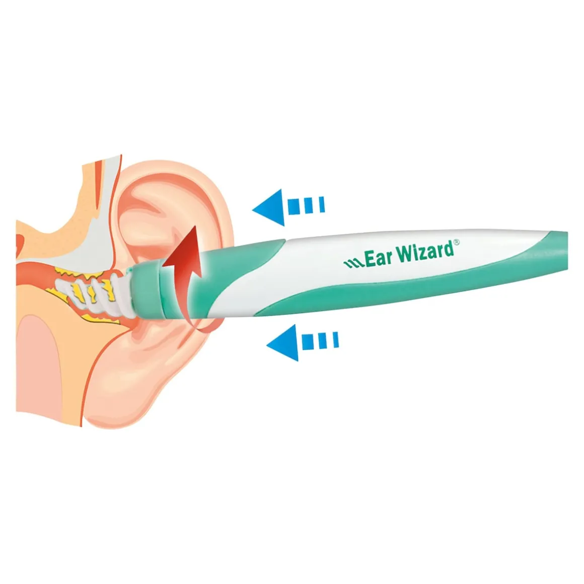 Ohrenreiniger "Ear Wizard"