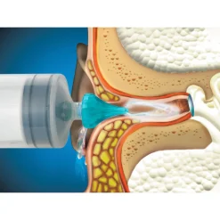 Ohrenwachs-Entfernungsspritze