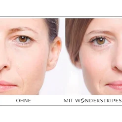 Wonderstripes, 64 Stück